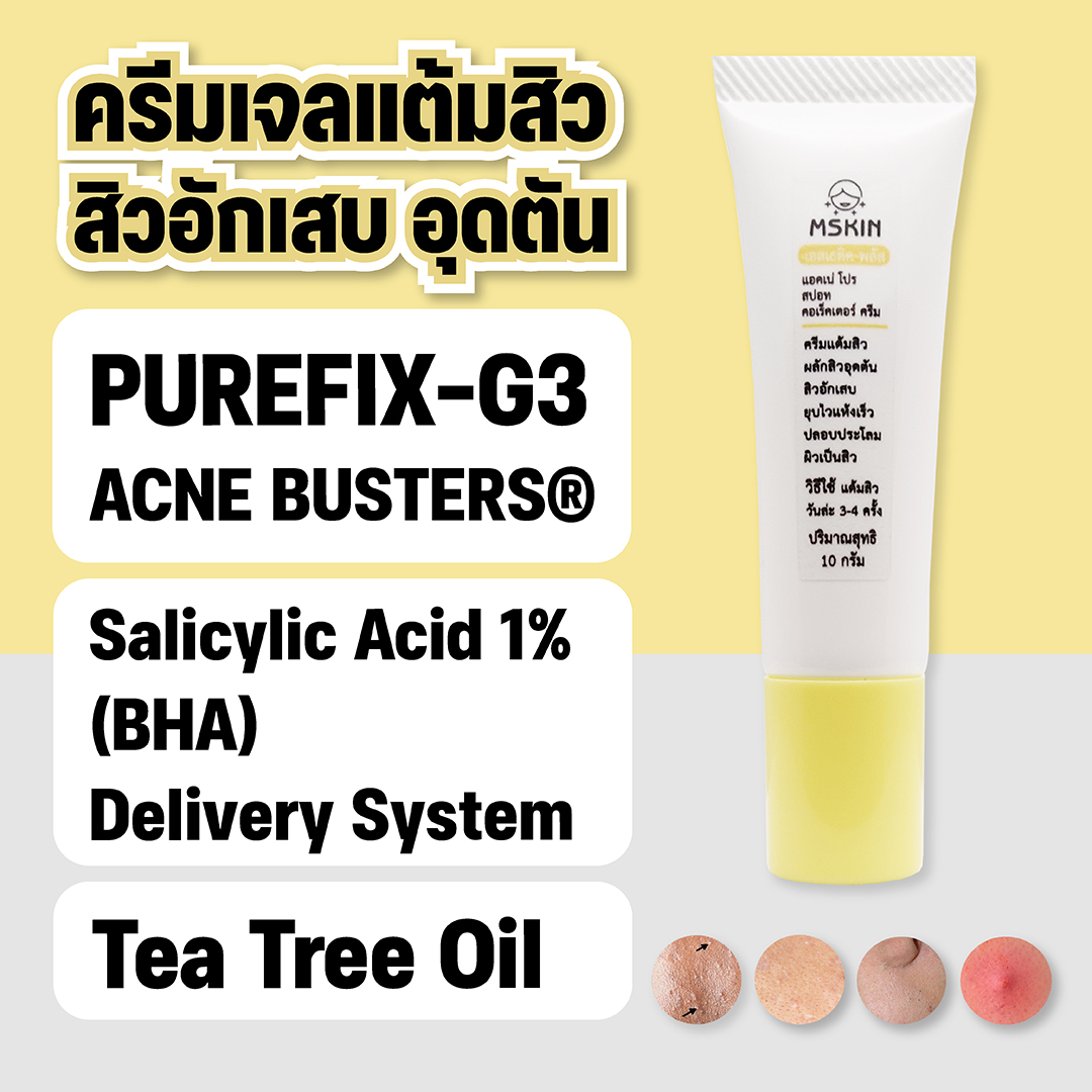 แอคเน่ โปร สปอท คอเร็คเตอร์ ครีม ครีมเจลแต้มสิว สิวอักเสบ สิวอุดตัน สิวหัวปิด สิวหัวขาว สิวยุบไว แห้งเร็วขึ้น
