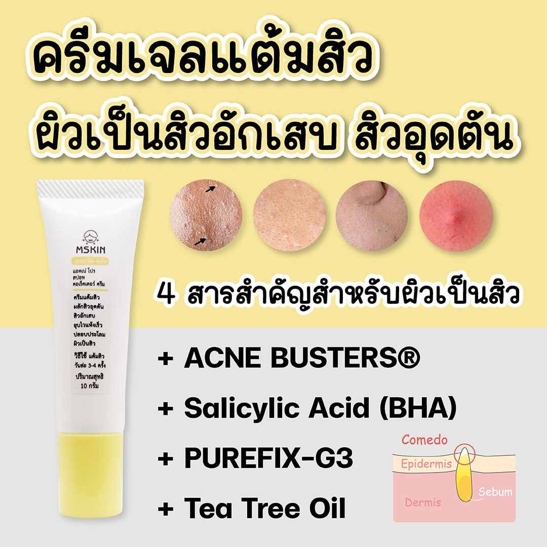 แอคเน่ โปร สปอท คอเร็คเตอร์ ครีม ครีมเจลแต้มสิว สิวอักเสบ สิวอุดตัน สิวหัวปิด สิวหัวขาว สิวยุบไว แห้งเร็วขึ้น